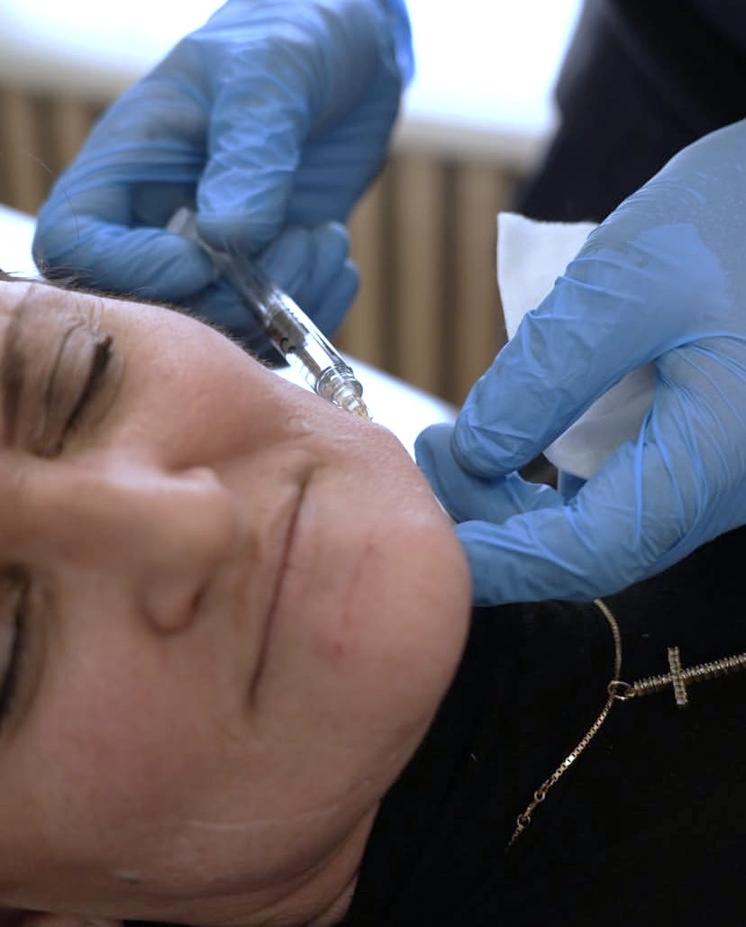 Remodelación Facial
