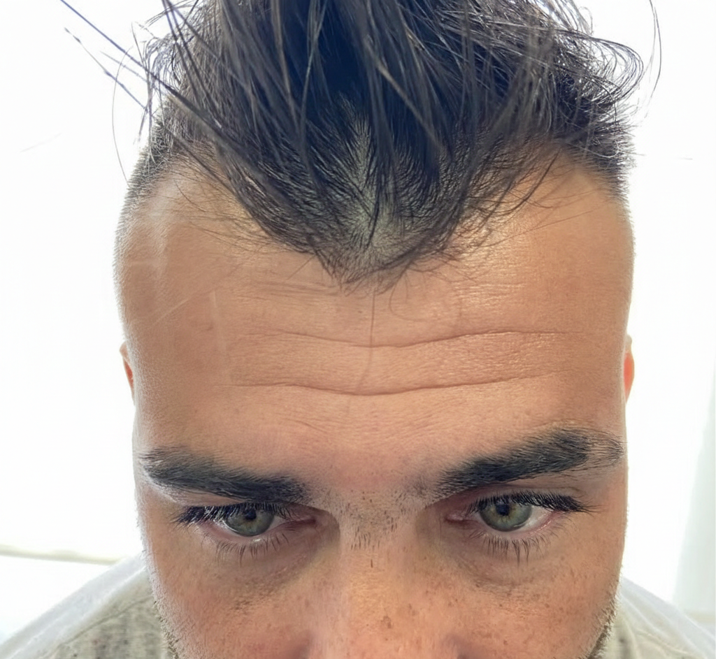 Antes