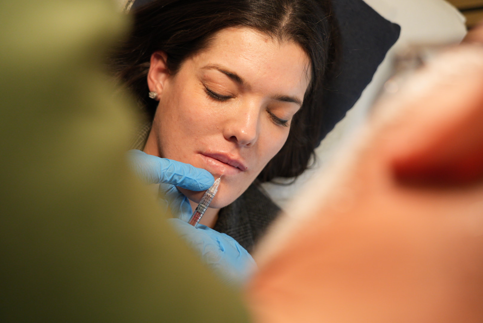Resultado Facial