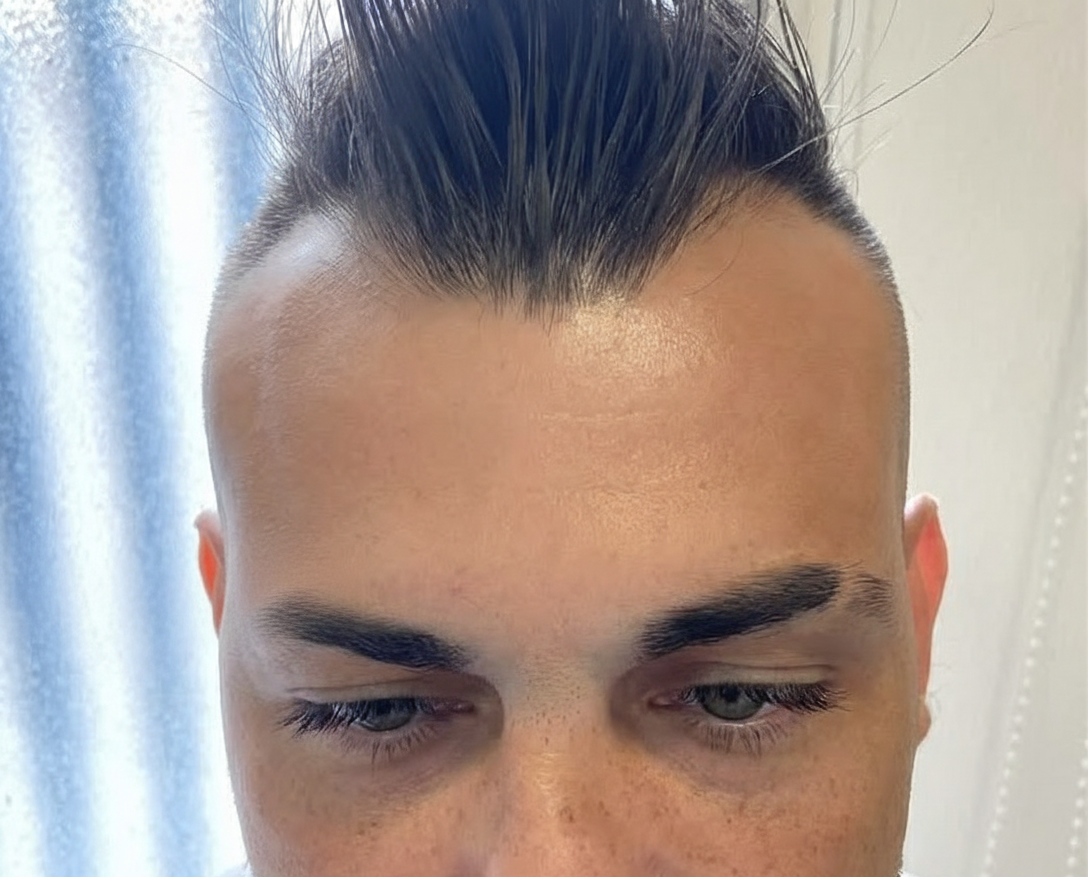 Resultado Frente