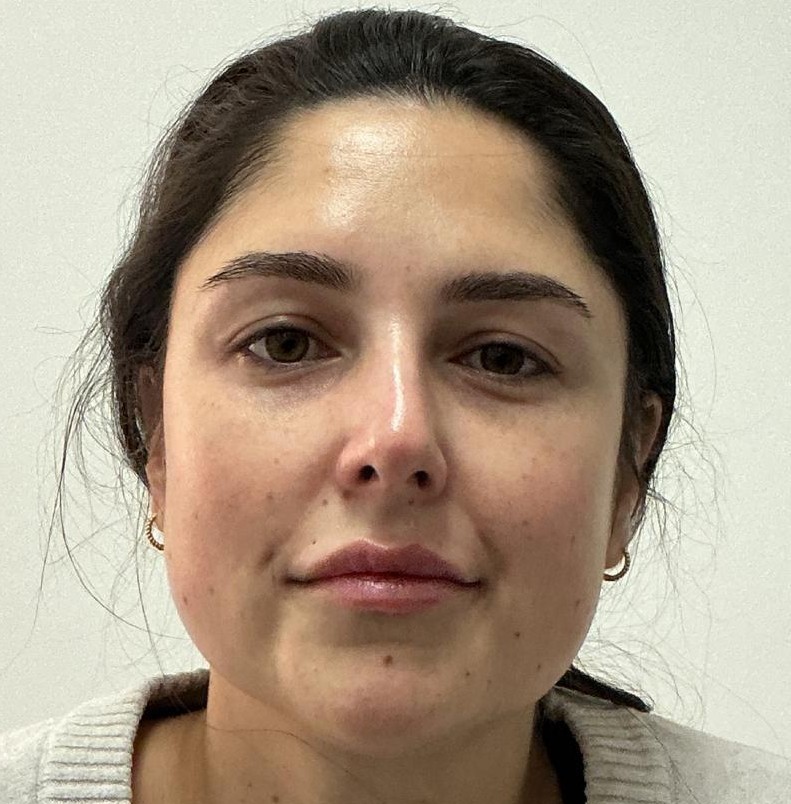 Retoque de Labios