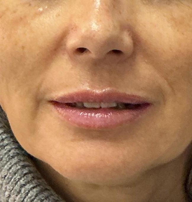 Hidratación de Labios