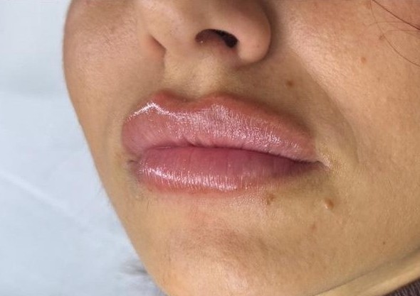 Hidratación Profunda Labios