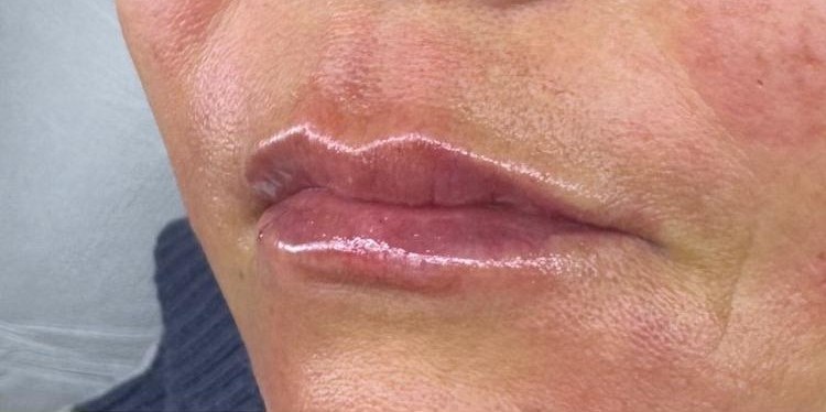 Hidratación Profunda Labios