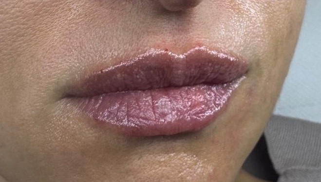 Hidratación Profunda Labios